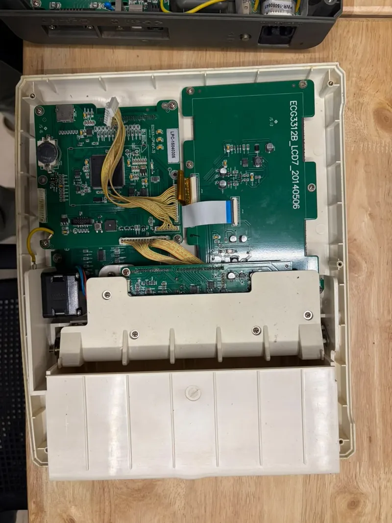 The inside of an ECG machine: a main circuit board, a display board and the paper printer housing
